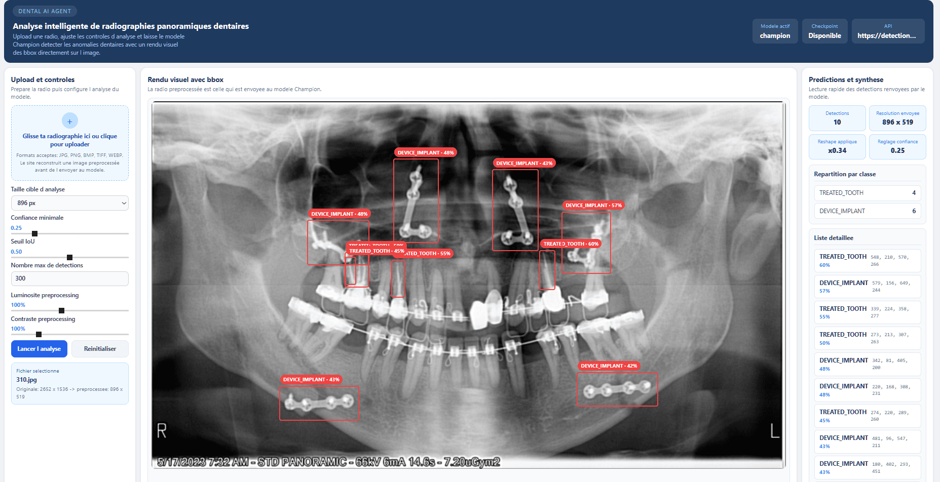 Détection de pathologies dentaires — MLOps